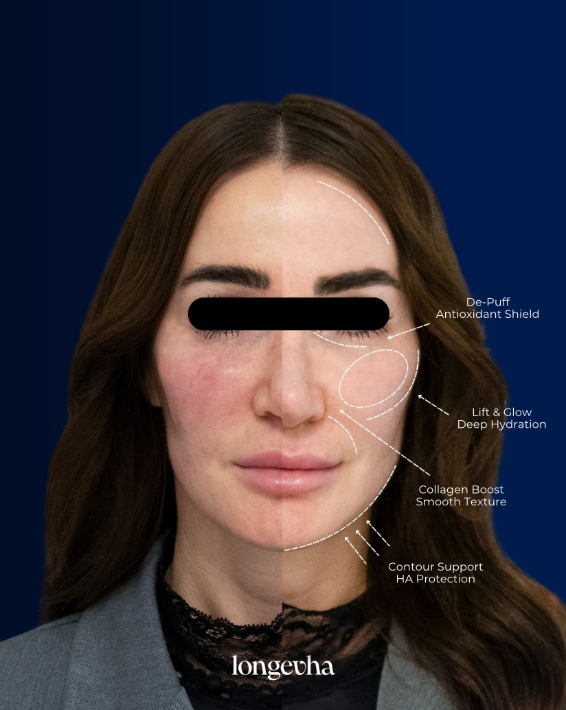 What does healthy-looking skin actually look like?
For many people, it isn't about changing their features. It's about improving the quality of the skin itself - hydration, radiance, texture and overall resilience.
LongevHA brings together dual molecular weight Hyaluronic Acid, NAD+ and Resveratrol in a formulation designed around a broader approach to skin quality.
Swipe your focus from the surface to what’s happening beneath it.
Follow @longevhauk for more science-led insights into the future of skin health.
#longevha #longevity #skinhydration #aestheticinnovation